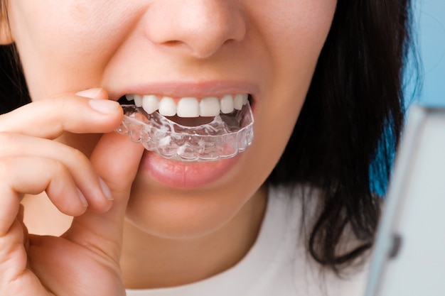 Foto mulher sorridente com dentes perfeitos e saudáveis usando aparelho removível