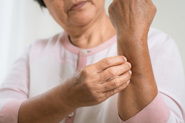 Mulheres idosas arranham o braço a coceira no braço de eczema