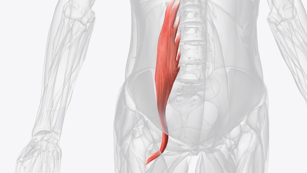 El músculo psoas es un músculo paraspinal ubicado profundamente en el cuerpo muy cerca de la columna vertebral y el borde de la pelvis menor