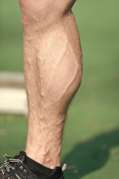 Foto muskulöses bein mit vene im stadion oder in der arena im sonnigen außenbereich fuß in schwarzem sportmodeschuh auf grünem gras gesundheit und gesunder lebensstil sporttraining und training