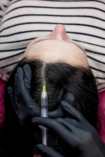 Foto nadel-mesotherapie. kosmetikerin macht injektionen in den kopf der frau. stärken das haar und sein wachstum.
