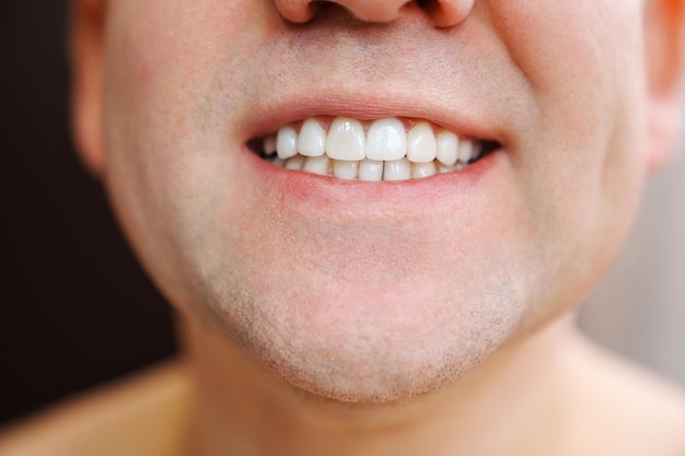 Nahaufnahme der Mund des Mannes 39 lächelt und zeigt weiße Zähne
