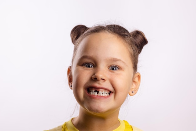 Nahaufnahme des glänzenden kleinen Kindergesichts, das den fehlenden vorderen Milchzahn zeigt und in gelbem T-Shirt auf weißem Hintergrund verrückt lächelt. Erste Zähne ändern. Zum Zahnarzt gehen, um eine Zahnbehandlung durchzuführen