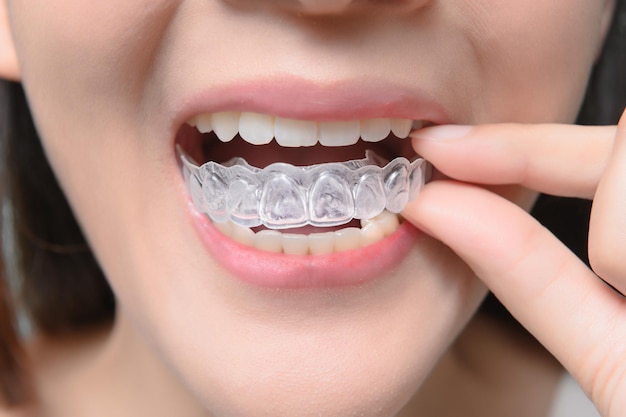 Nahaufnahme einer Frau, die Plastikspangen hält