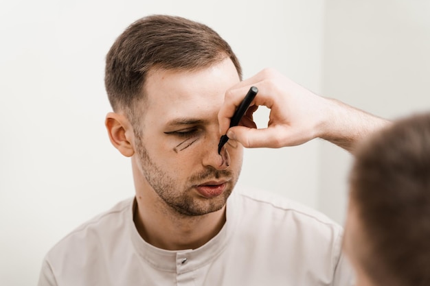 Nahaufnahme einer männlichen Nasenkorrektur Blepharoplastik mit Hernienentfernungsmarkierung im Gesicht vor einer plastischen Operation zur Modifizierung der Augenregion und Neuformung der Nase zur Veränderung des Aussehens