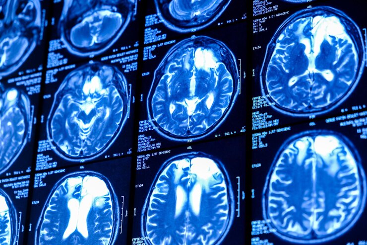 Nahaufnahme eines CT-Scans mit dem Gehirn. Medizin, Wissenschaft und Bildung. MRT-Hintergrund des Gehirns. Magnetresonanztomographie. Tomographie-Aufnahme