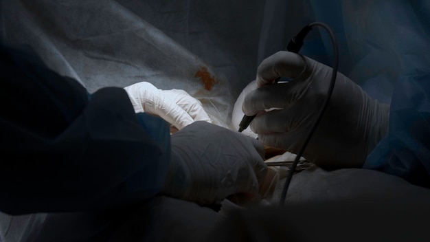 Nahaufnahme von professionellen Chirurgen, die während eines medizinischen Eingriffs eine offene Wunde kauterisieren
