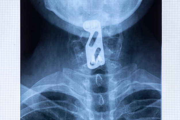 Foto nahaufnahme von röntgenbildern auf dem tisch