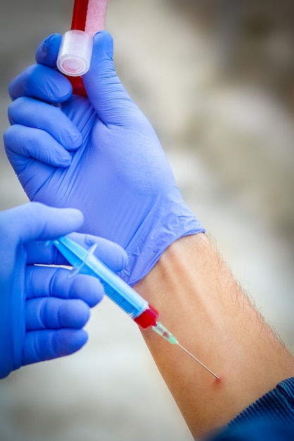 Foto nas mãos de um tubo de ensaio com sangue para análise do vírus. covid-19 é um perigo para a população infecciosa do ar.