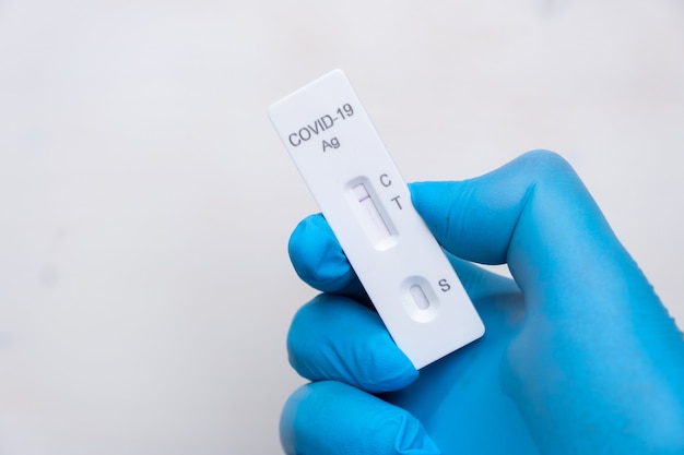 Foto negativer covid-antigen-test zum schnellen nachweis von krankheiten in der hand des arztes in den gummihandschuhen