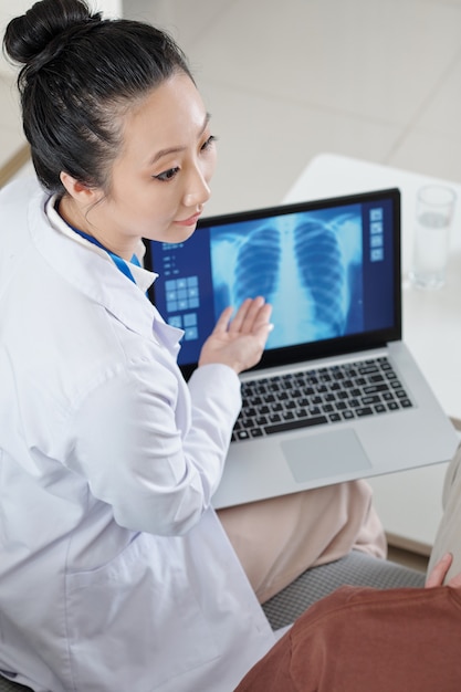 Neumólogo apuntando a la radiografía de las orejetas en la pantalla de la computadora portátil cuando habla con el paciente sobre su enfermedad