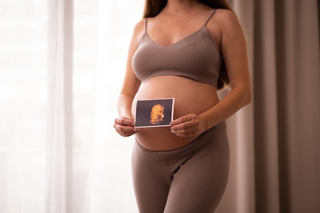 Nicht erkennbare kaukasische schwangere Frau mit 3D-Ultraschall-SonogrammFoto auf Babybauch in der Nähe des Fensters beschnittene AufnahmePastellfarbenNatürlichgesundschönes SchwangerschaftskonzeptCopyspace für Text