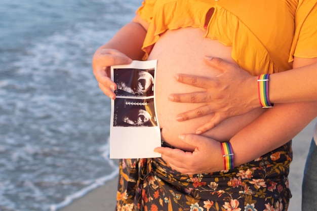 Nicht erkennbares lesbisches Paar, das ein Baby erwartet