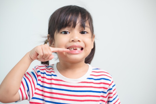 Niña asiática mostrando sus dientes de leche rotos