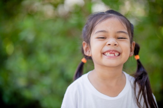 Niña asiática muestra un diente que falta