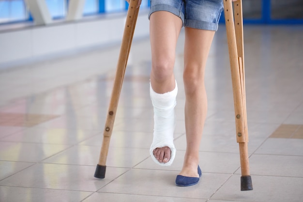 Una niña está con muletas en el pasillo del hospital.