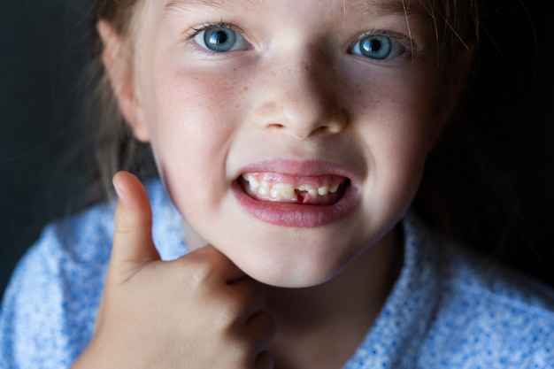 una niña feliz perdió su diente frontal
