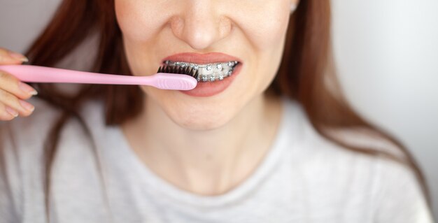 Una niña con frenillos en sus dientes blancos y un cepillo de dientes.