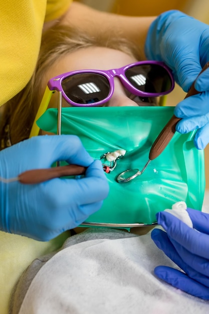 Una niña pequeña con un dilatador oral en el tratamiento de la cita con el dentista y el pulido de los dientes después de la reconstrucción y el empaste Paciente con la boca abierta acostado en la silla del dentista