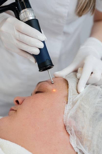 Una niña recibe un peeling facial de carbón en un salón de belleza de primer plano Los pulsos láser limpian la piel de la cara Cosmetología de hardware El proceso de fototermólisis que calienta la piel