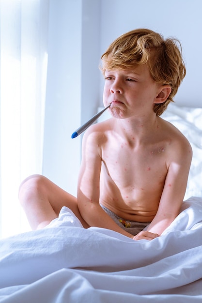 Niño enfermo sin camisa con ampollas de varicela mirando hacia otro lado y sosteniendo un termómetro digital en la boca mientras está sentado en la cama y midiendo la temperatura en casa