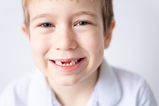 Un niño pequeño ha perdido sus primeros dientes de leche La boca de un niño sin dientes en primer plano Un diente caído Cuidado de los dientes de leche y la cavidad bucal
