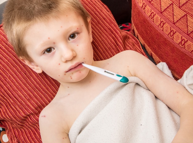 Foto niño con varicela que mide la fiebre