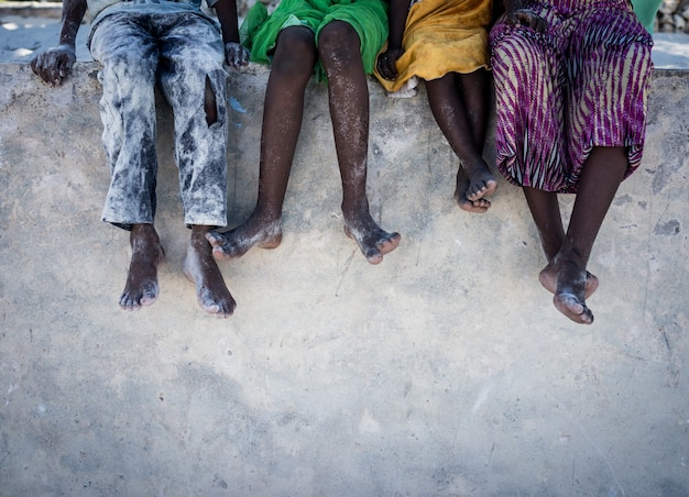 Niños africanos sentados en la pared con los pies hacia abajo