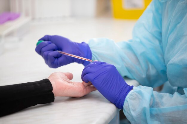 O assistente de laboratório faz um exame de sangue Exame de sangue do dedo