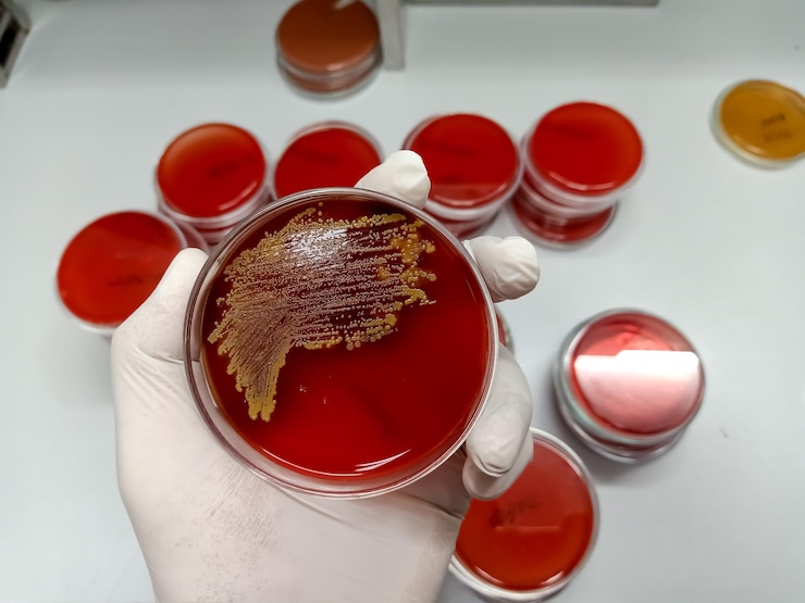 Foto o bioquímico do tecnólogo de laboratório mantém o crescimento da cultura de bactérias na placa de mídia seletiva