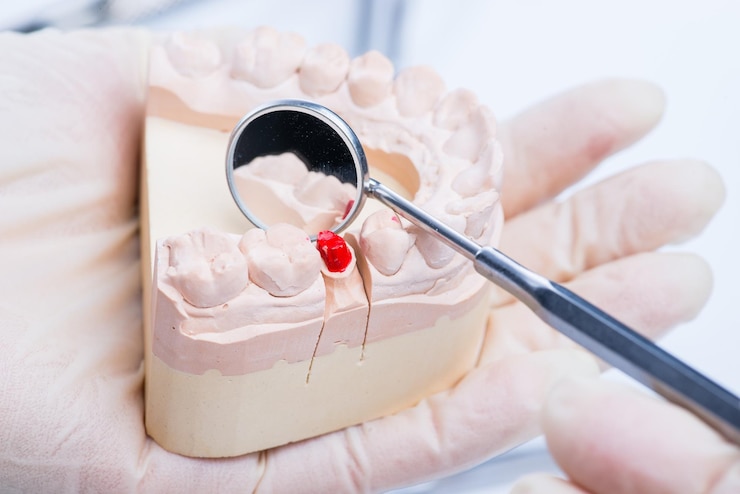 Foto o dentista examina o molde dos dentes