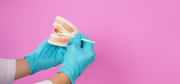 O dentista segura o modelo ortodôntico dos dentes e o espelho dental em fundo rosa Mão usa luva de látex azul