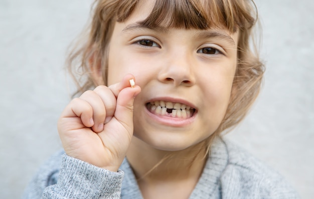 O garoto tinha um dente de leite.