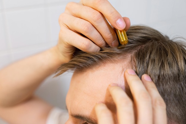 O homem branco caucasiano de meia idade usa se aplica ao cabelo com ampolas cosméticas com soro para restauração do crescimento do cabelo beleza do cabelo O conceito do problema da calvície e alopecia da perda de cabelo masculino