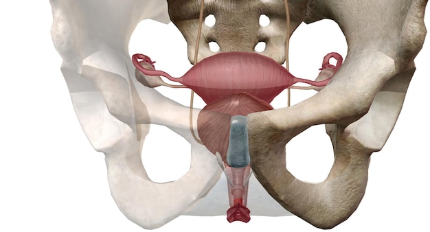 Foto o ligamento entre a uretra e a vagina