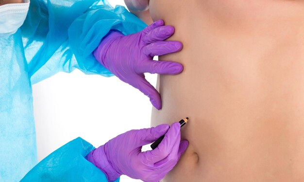 O médico com luvas violetas está desenhando sob o peito do paciente para a futura cirurgia
