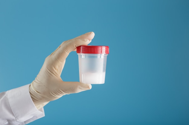 O médico segura um frasco de plástico com sêmen na mão