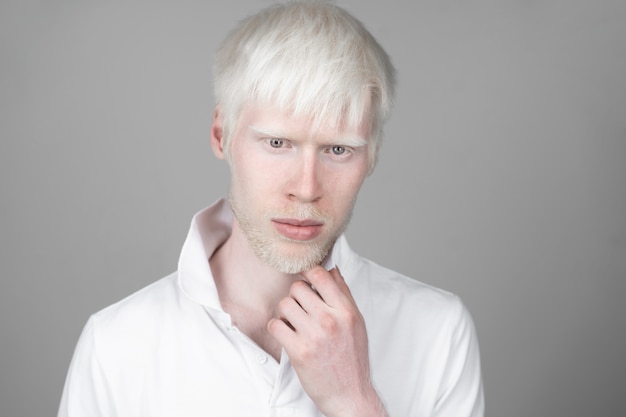 O retrato de um homem do albino no estúdio vestiu o t-shirt isolado em um fundo branco. desvios anormais. aparência incomum. anormalidade da pele