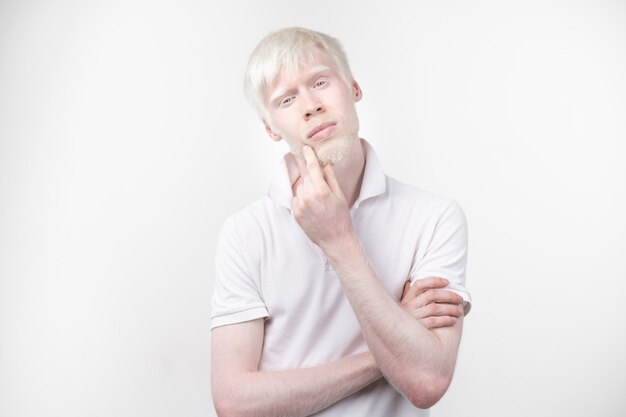 O retrato de um homem do albino no estúdio vestiu o t-shirt isolado em um fundo branco. desvios anormais. aparência incomum. anormalidade da pele