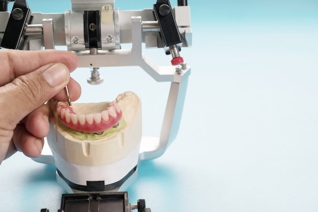 O trabalho de implante dentário está concluído e pronto para uso / pilar temporário para implante dentário