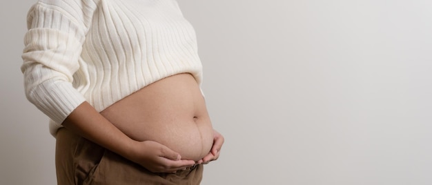 Una obesidad que lleva su vientre regordete para mostrar el concepto de mujer gorda malsana