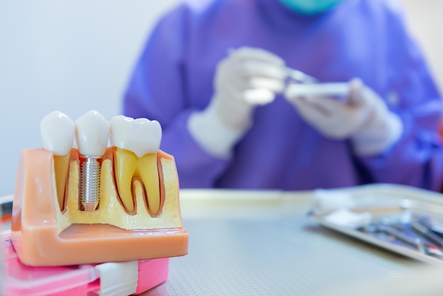 Odontologia e conceito de saúde dos dentes na clínica odontológica. dentes de exame de dentista