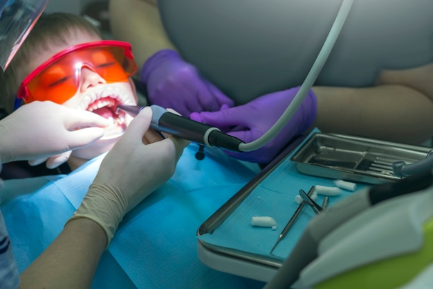 Odontologia para crianças. Dentes de bebê de exame de dentista infantil. Garotinho em óculos de proteção laranja e cofferdam. Cárie de tratamento de processo. Foco seletivo, ruído artificial