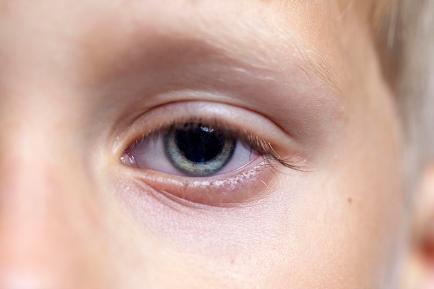 Ojo azul en la cara del niño Primer plano Visión y salud