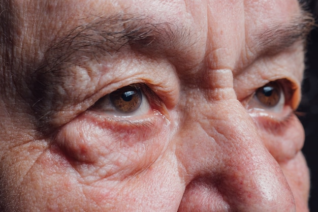 Foto los ojos de las personas mayores se cierran para arriba contemplativa vieja mujer caucásica mirando a la cámara macro