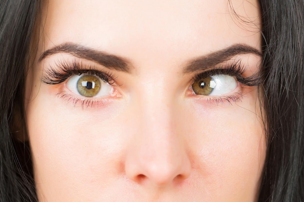 Foto olhos femininos loucos com estrabismo