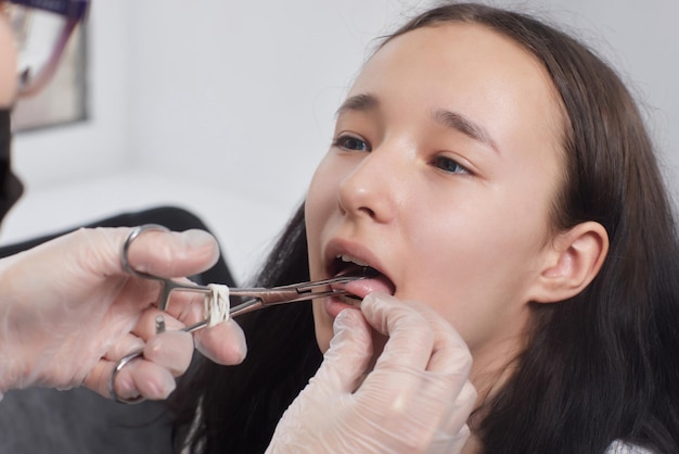 Operação de piercing na língua Profissional segurando a joia