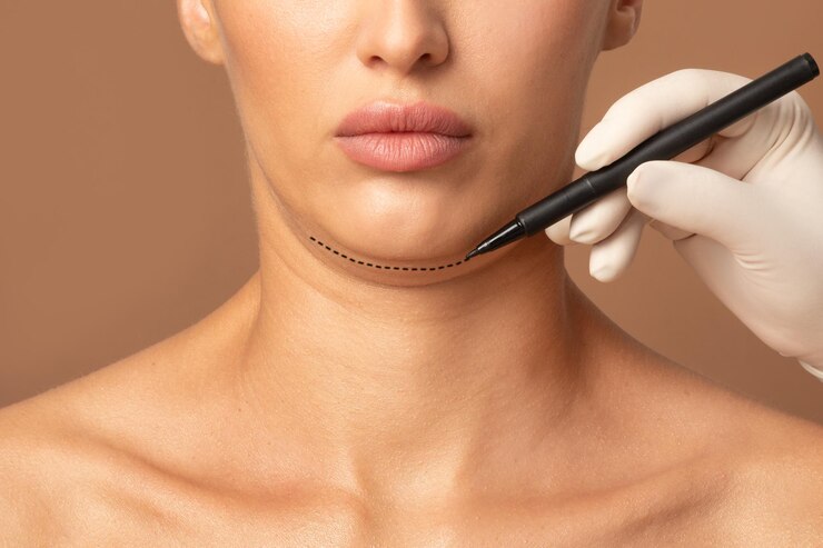 Foto operação de remoção de queixo duplo conceito de cirurgia plástica médico cirurgião mãos desenhando a linha de corte de