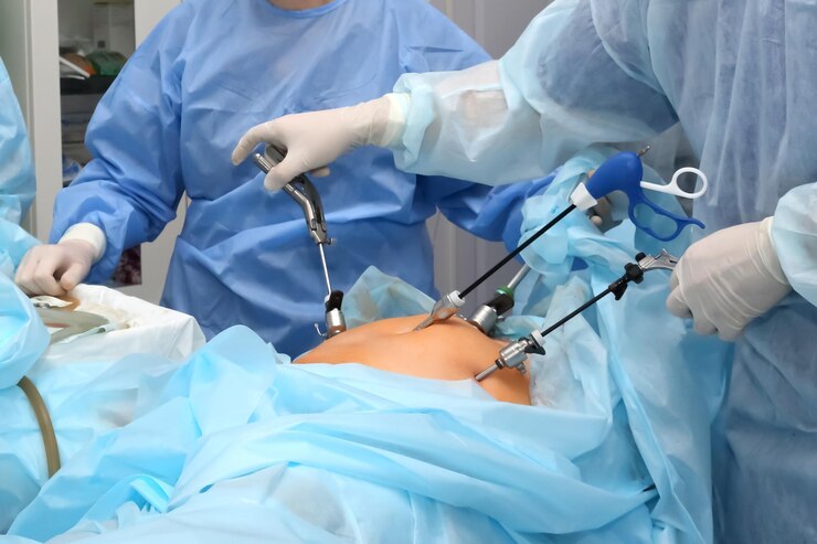 Operação no estômago Procedimento médico para tratar um paciente com intervenção cirúrgica na sala de cirurgia