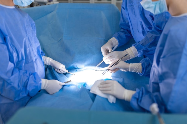 Operación de cirugía Grupo de cirujanos en quirófano con equipo de cirugía Antecedentes médicos Enfoque selectivo Equipo de cirujanos trabajando juntos durante la operación